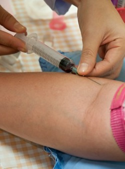 Drawing Blood for the Fasting Blood Sugar Test